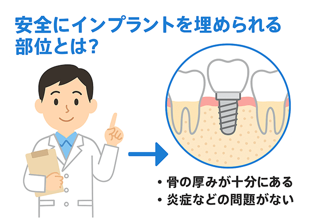 安全に埋められる部位