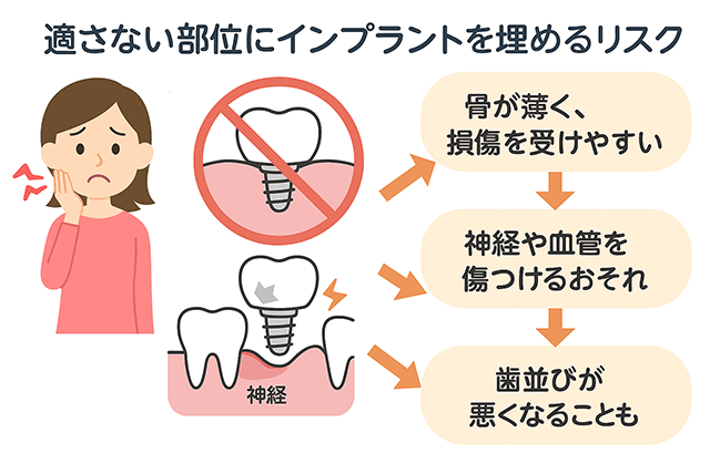 適さない部位に埋めるリスク