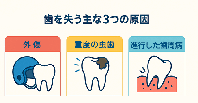 歯を失う主な3つの原因