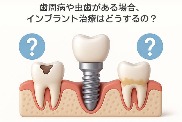 歯周病や虫歯がある場合はどうするの?
