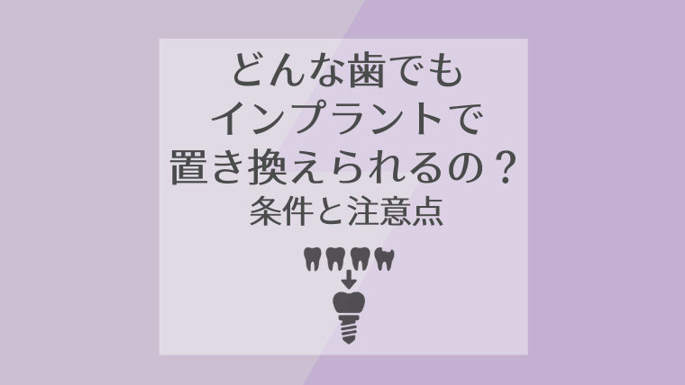 どんな歯でもインプラントで置き換えられるの?