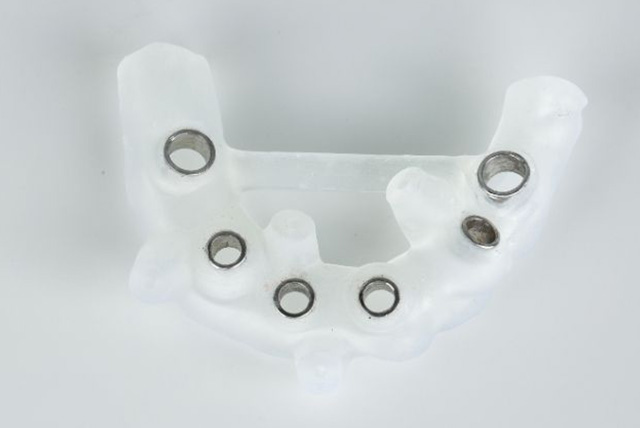 サージカルガイド