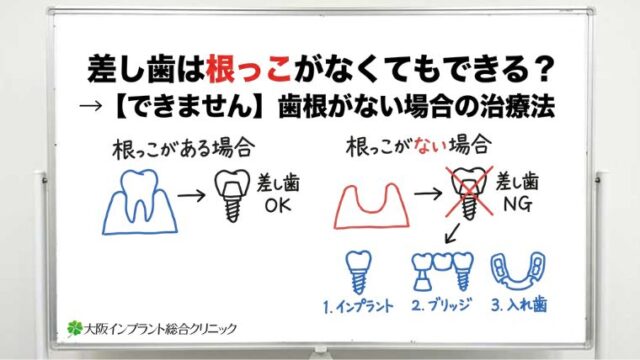 差し歯は根っこがなくてもできる？歯根がない場合の治療法