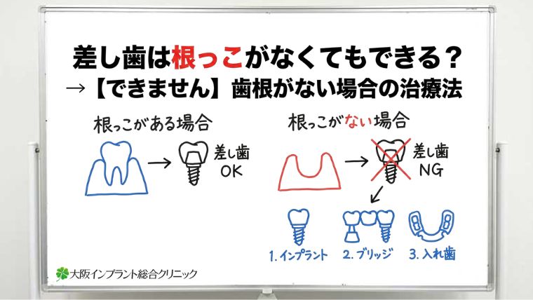 差し歯は根っこがなくてもできる？歯根がない場合の治療法