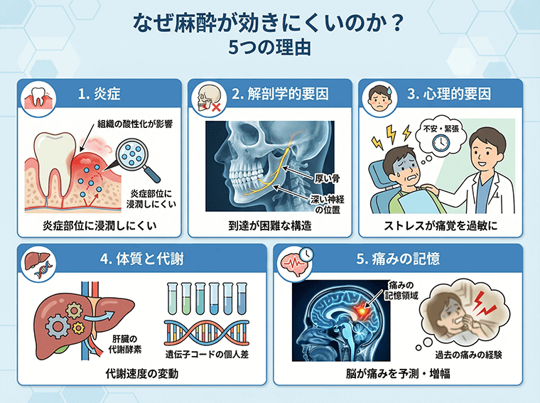ならや　歯内、麻酔、衛生、インプラント インプラント手術した夜に、麻酔が切れたら？｜インプラント総合情報