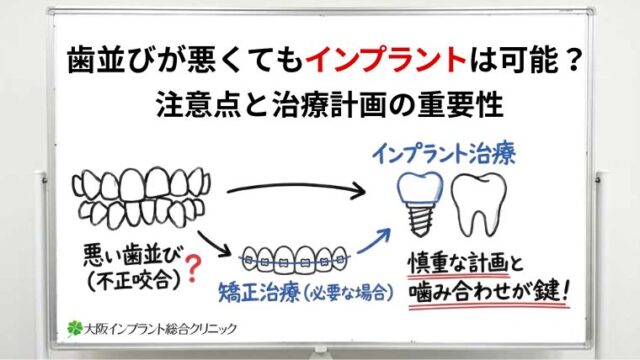 歯並びが悪い場合でもインプラント治療はできる？注意点と治療の考え方を解説