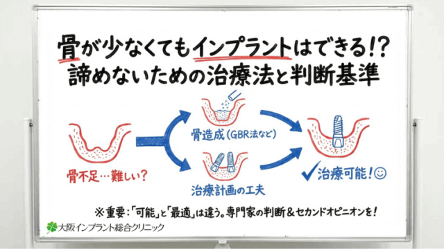 骨が少ないと本当にインプラントはできないのでしょうか？治療が可能なケースと判断のポイント