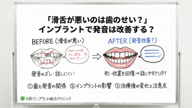 滑舌が悪いのは歯のせい？インプラントで発音は改善するのか解説