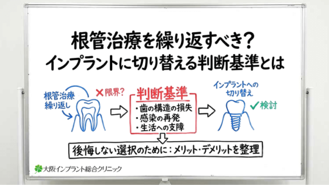 根管治療を繰り返すべき？インプラントに切り替える判断基準とは