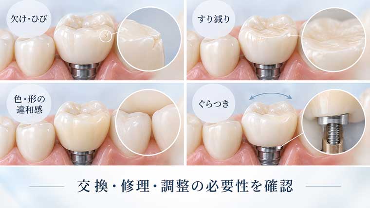 上部構造の欠け、ひび、破損