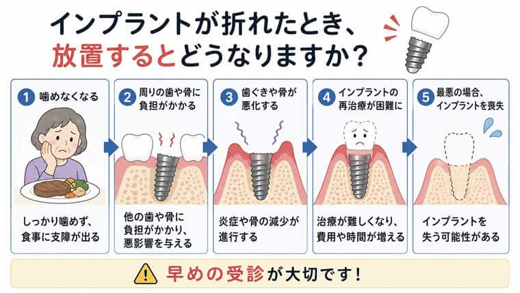 インプラントが折れたとき、放置するとどうなる？の図解