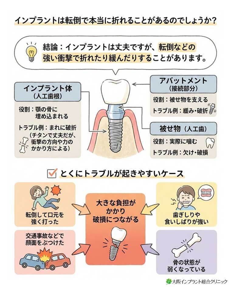 インプラントは転倒で本当に折れることがあるのでしょうか？の図解