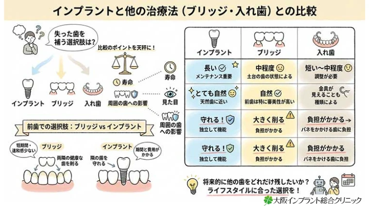 他の治療法（ブリッジ・入れ歯）との比較の図解