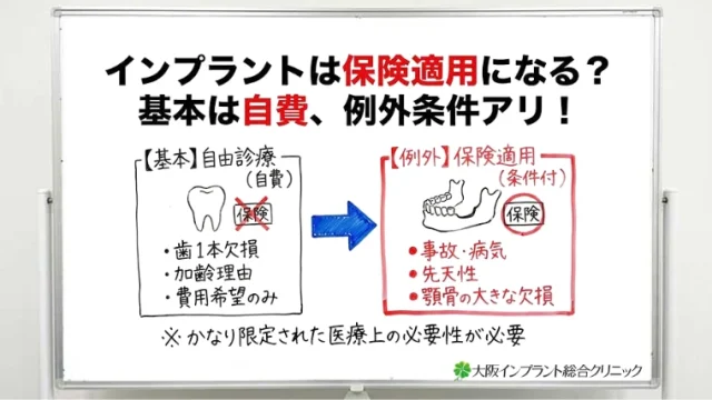 インプラントは保険適用になる？対象となる症例と条件を詳しく紹介