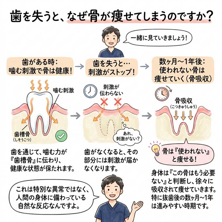 歯を失うと、なぜ骨が痩せてしまうのですか？の図解
