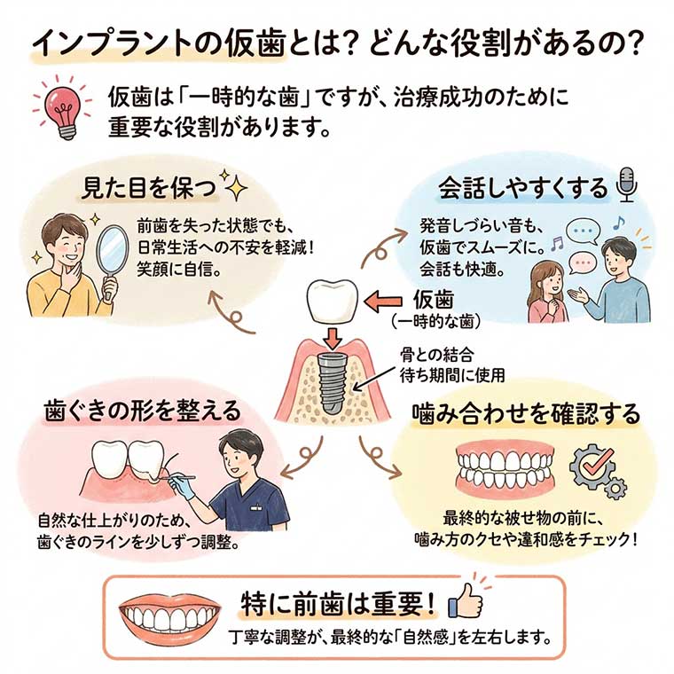 インプラントの仮歯とは？どんな役割があるの？の図解