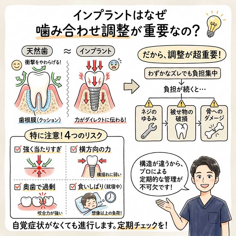 インプラントはなぜ噛み合わせ調整が重要なの？の図解