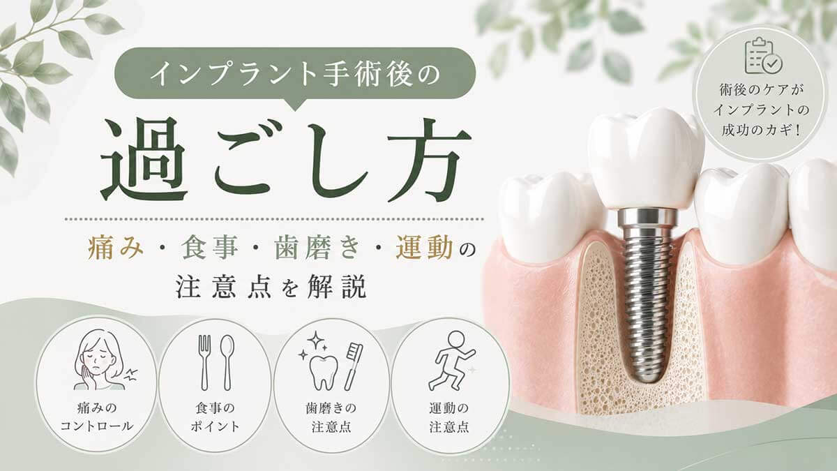 インプラント手術後の過ごし方の基礎知識｜痛み・食事・歯磨き・運動の注意点