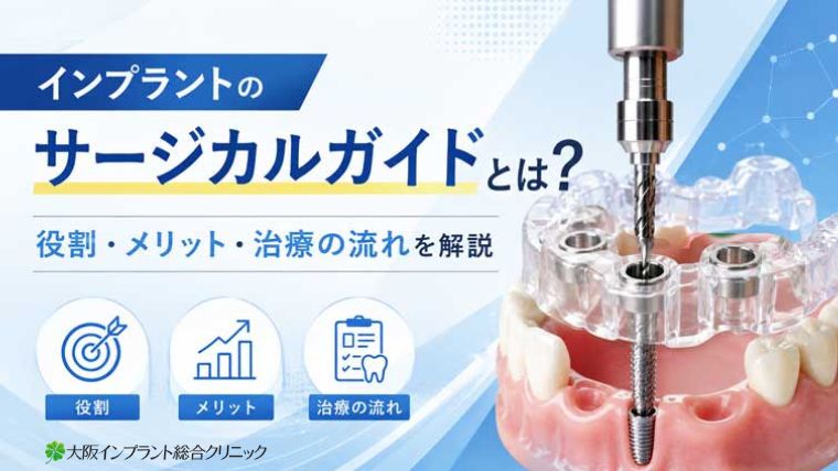 インプラントのサージカルガイドとは？役割・メリット・治療の流れを解説