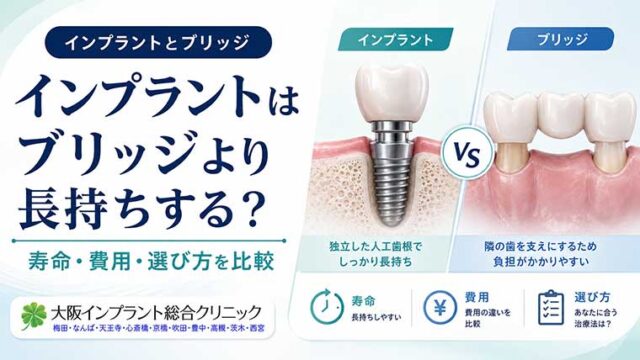 インプラントはブリッジより長持ちする？寿命・費用・選び方を比較