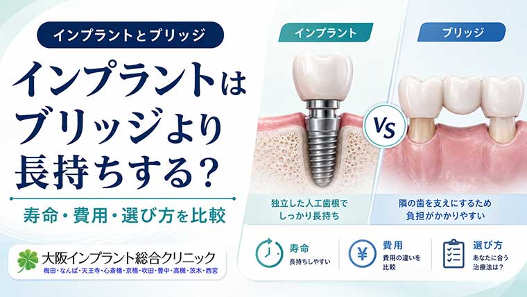 インプラントはブリッジより長持ちする？寿命・費用・選び方を比較