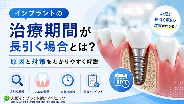 インプラントの治療期間が長引く場合とは？原因と対策をわかりやすく解説