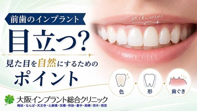 前歯のインプラントは目立つ？見た目を自然にするためのポイント