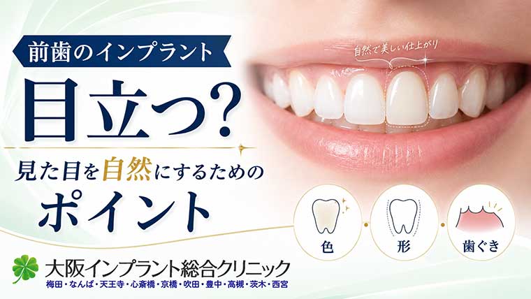 前歯のインプラントは目立つ？見た目を自然にするためのポイント