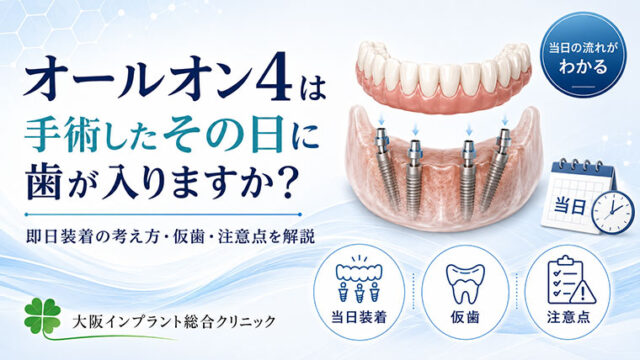 オールオン4は手術したその日に歯が入りますか？