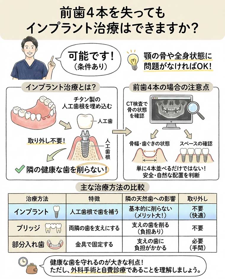 前歯4本を失ってもインプラント治療はできますか？の図解