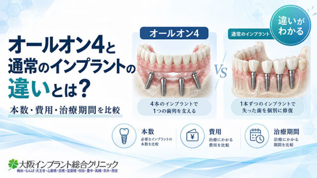 オールオン4と通常のインプラントの違いとは？本数・費用・治療期間を比較