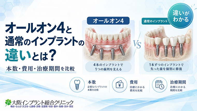 オールオン4と通常のインプラントの違いとは？本数・費用・治療期間を比較