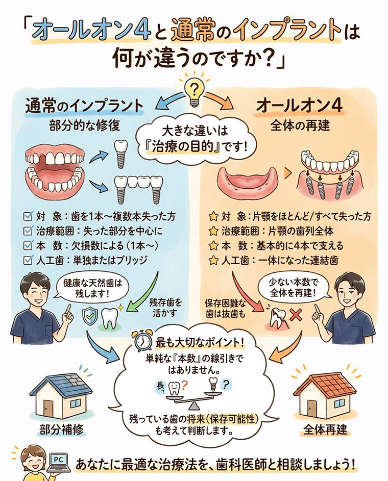 オールオン4と通常のインプラントは何が違うの？の図解