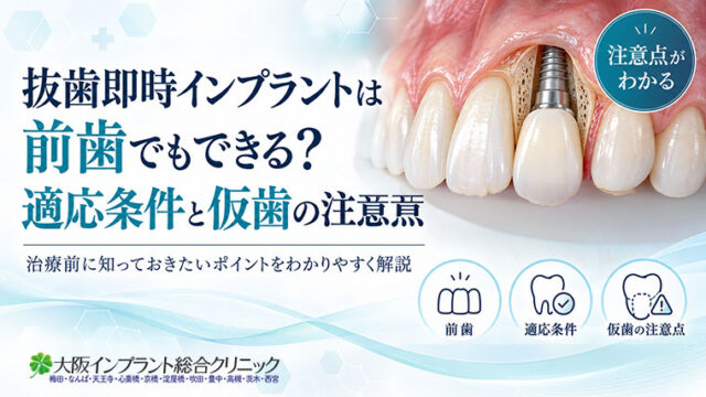 抜歯即時インプラントは前歯でもできる？適応条件と仮歯の注意点