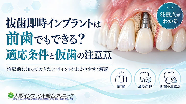抜歯即時インプラントは前歯でもできる？適応条件と仮歯の注意点
