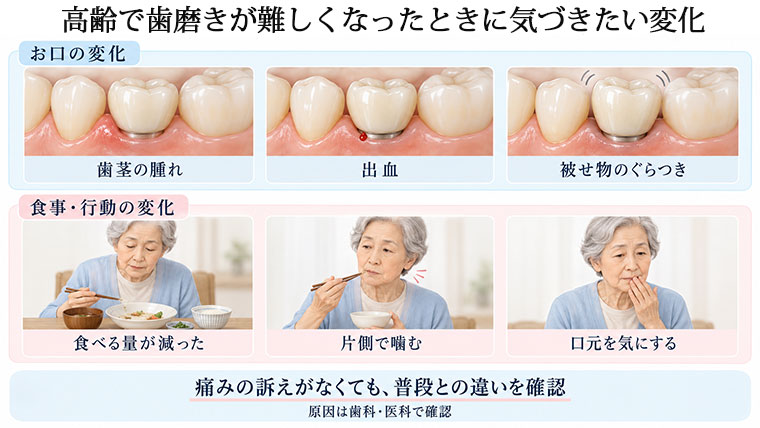 歯磨きが出来なくなったとき問題