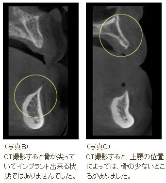 CT摜