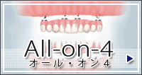 オールオンフォー(all-on4)