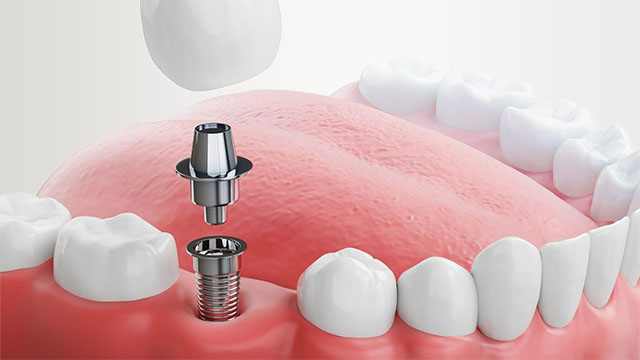 �C���v�����g