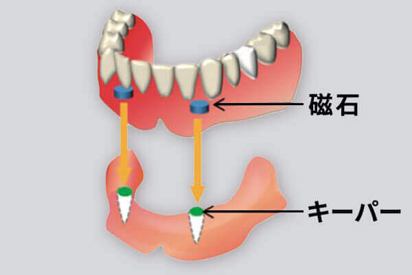 ΂̓ꎕ