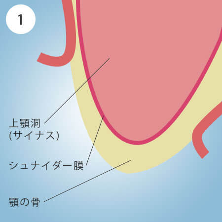 TCiXtgtg̎菇1