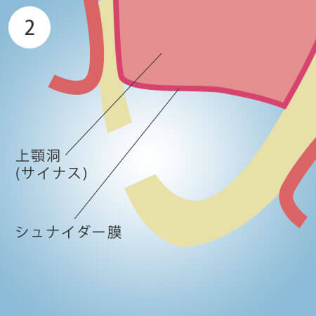 TCiXtgtg̎菇2