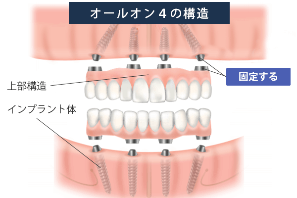 I[I4̍\